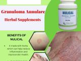 Herbal Supplements for Granuloma Annulare.jpg